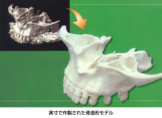 実寸で作製された骨造形モデル